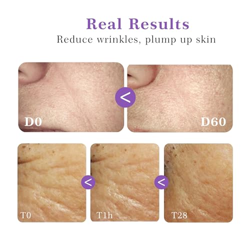 JING MENG 2 PCS JING MENG Argireline Matrixyl 3000 Serum,Plump up Skin, Anti Aging, Instantly Firming, Liposomal Retinol, Collagen Boost Peptides Serum For Face Neck Eyes Breast 1oz*2