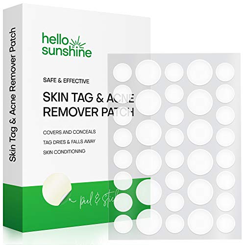 Skin Tag and Acne Remover Patches, Tags dries and fall away,Natural Ingredients, improved