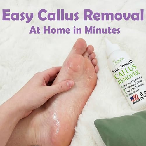 Image of Callus Remover for Feet (Extra Strength 8 oz) Foot Callus Remover Gel, Spa Foot Care, Pedicure Tools for Feet Scrubber