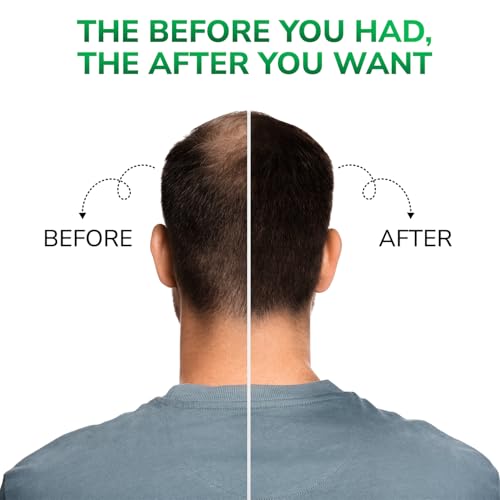 Image of HAIROUSE Natural Hair Building Microfibers (Natural Brown) 15 Gms | Hair Fibre to Cover Bald Patches, Thinning Hairs, Instant Volume & Fuller Look for Men & Women | Ecofriendly & Biodegradable