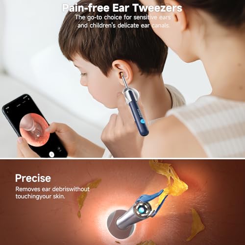 Image of BEBIRD R1 Ultra Ear Wax Remova, Ear Cleaner with Camera Ear Scope, Wax Remove Ear Pick with Ear Otoscope Tweezers, Visual Dropper Cleaning Kit, Ear /Nose /Throat Examination Tool for Family, Blue