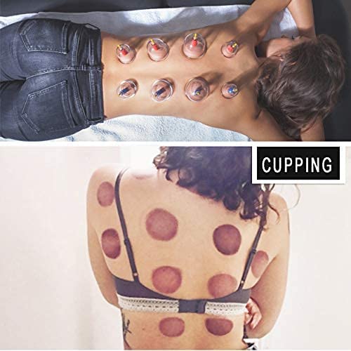 Muchoo Cupping Set Professional Chinese Acupoint Cupping Therapy Sets Suction Hijama Cupping Set With Vacuum Magnetic Pump Cellulite Cupping Massage Kit 22-Cup #TOP4