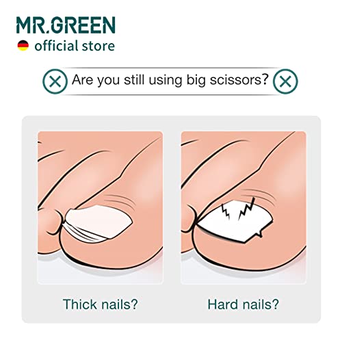 Coupe-ongles d'orteils en acier inoxydable MR.GREEN de haute précision