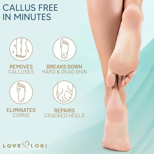Love Lori Foot Callus Remover Gel Extra Strength Pedicure Tool for Feet 6oz - 4