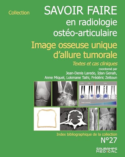 livre Savoir faire en imagerie ostéo articulaire n° 27: Imagerie osseuse unique d'allure tumorale