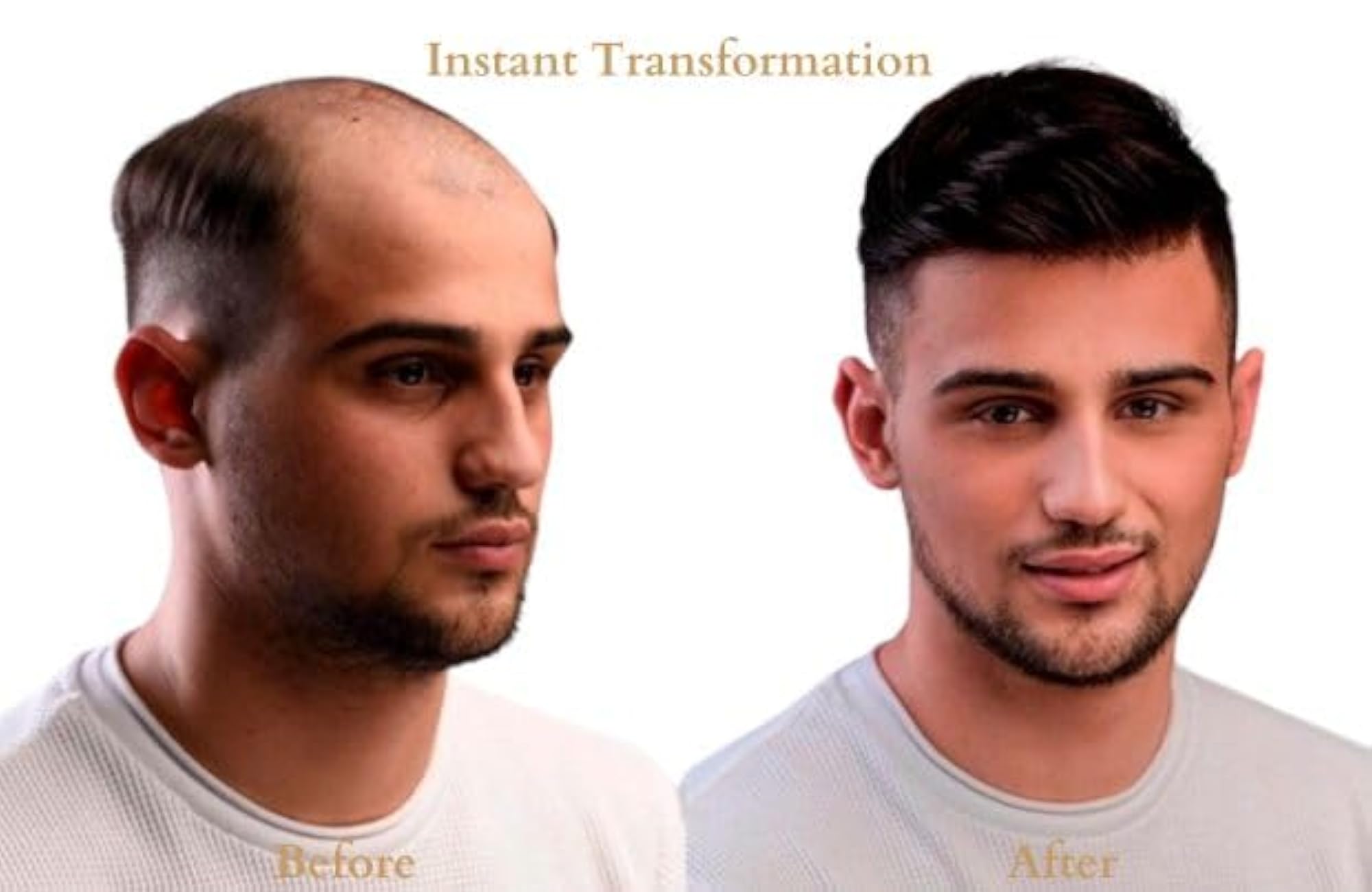 Men's Australian Patch Hair Replacement System, Durable Toupee