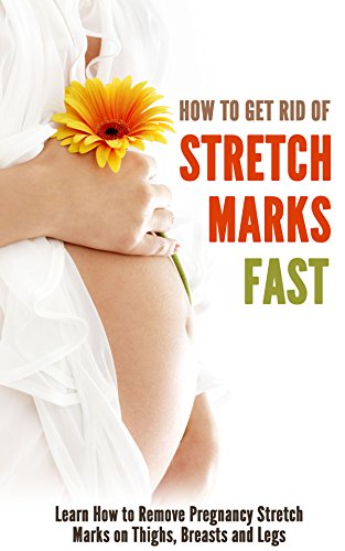 How to Get Rid of Stretch Marks Fast: Learn How to Remove Pregnancy Stretch Marks on Thighs, Breasts and Legs