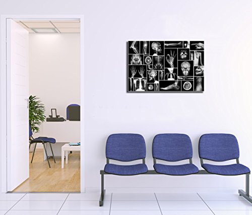 Black And White Human Skull Wall Art Canvas Painting X-Ray Picture Poster Prints Wall Picture For Hospital Orthopedic Surgeon Office Wall Decor Ready Hanging On 24X36Inch (24"X36", Black And White) #TOP1