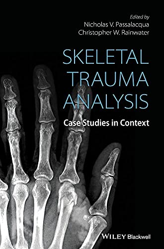 Skeletal Trauma Analysis: Case Studies in Context view 2