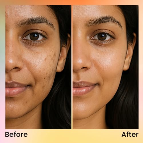 Image of FACES CANADA Comfy Glow 10% Vitamin C Face Serum - 15ml | Brightens Complexion | Dark Spot Reduction | Lightweight | Prevents Premature Aging | Hydrating & Healthier Looking Skin