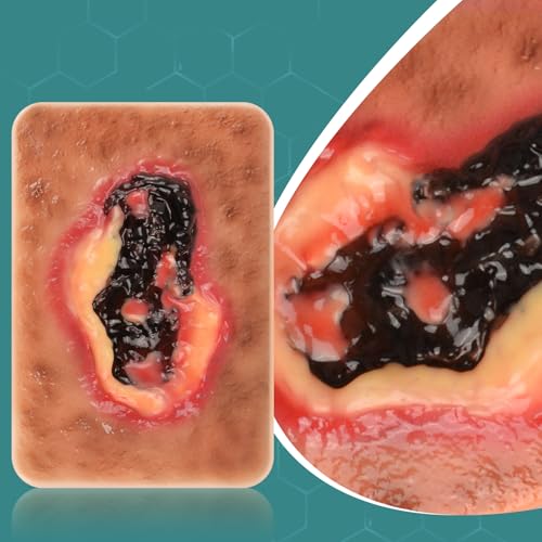 Image of Dry Necrotic Wound Simulation Model for Medical Education