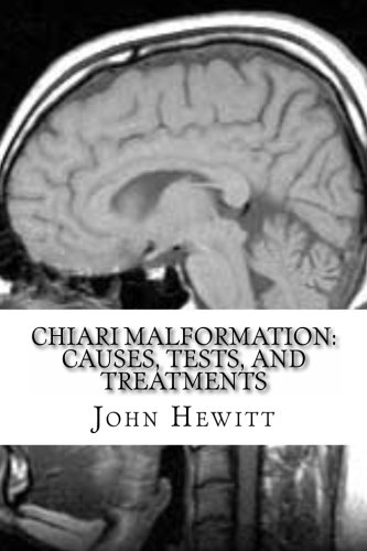 Chiari Malformation: Causes, Tests, and Treatments Chiari Malformation: Causes, Tests, and Treatments