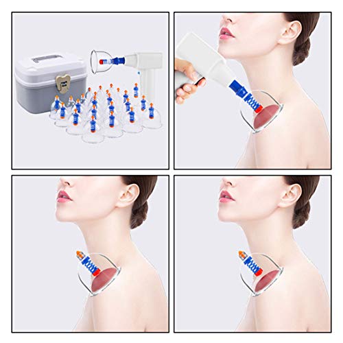 Acupuncture par ventouses électriques et perte de poids efficace - 6