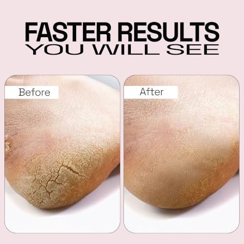 Image of Soulflower Epsom Salt for Foot, Bath & Body Spa, Swelling & Soreness, Relaxing, Muscle Pain Relief | 100% Pure USP Grade Epsom Salt| Pure Lavender Essential Oil 1 kg (Pack of 1)