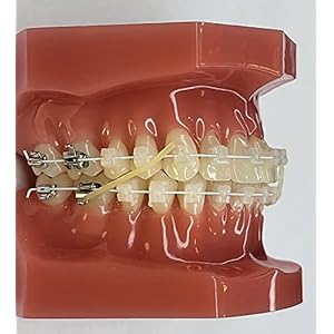 Dr.One Set van 4 tandheelkundig/orthodontisch stevige elastieken (denatl/ortho elastiek/O-ring) van natuurlijk latex voor orthopeditie, vaste gesp en aligner, Invisalign, onzichtbare rails