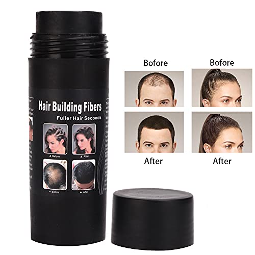 Hair Fibers For Thinning Hair, Hair Building Fibers For Women & Men Hair Loss Concealer Hair Powder, Instantly Thickens Thinning Or Balding Hair(Black) #TOP3