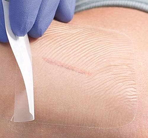 Opsite Flexifix Transparent Film Roll, 10 cm x 1 m