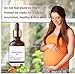 HYD Stretch Marks Ayurvedic Oil with Powerful Ingredients- 100% Ayurvedic, Increases Skin Elasticity, 30 Ml