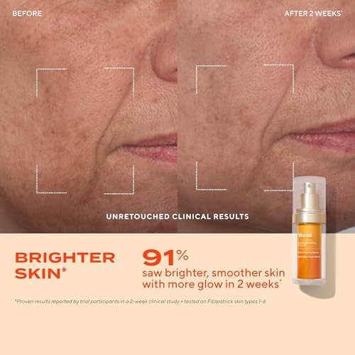 Best Vitamin C Serum for Oily Skin: Top Dermatologist-Recommended Picks for 2026 2 Murad Vita-C Glycolic Serum - Advanced Brightening Vitamin C and Glycolic Acid Face Serum for Improved Skin Tone and Texture - Gold-Stabilized Vitamin C for Enhanced Efficacy and Potency - 1 Fl Oz