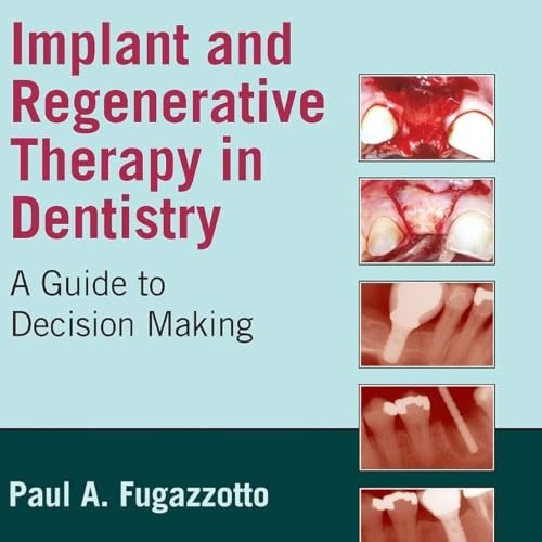 Implant and Regenerative Therapy in Dentistry: A Guide to Decision Making