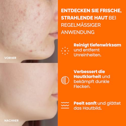 PLANTIFIQUE Kojisäure und Kurkuma Peeling Pads mit Ceramiden, Niacinamid, Vitamin C - Reinigungspad für Gesicht - Kojic Acid & Turmeric Pads - Peelt & Spendet Feuchtigkeit, 60 Stück