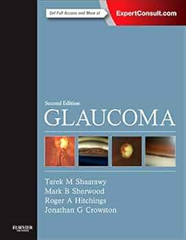 GLAUCOMA 第2版 volume 2のみ 41U8Bf1J7pL._UF350,350_QL50_.jpg