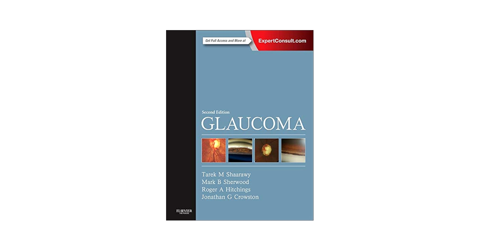 GLAUCOMA 第2版 volume 2のみ GLAUCOMA 第2版 volume 2のみ Amazon.co.jp: Glaucoma E-Book: 2