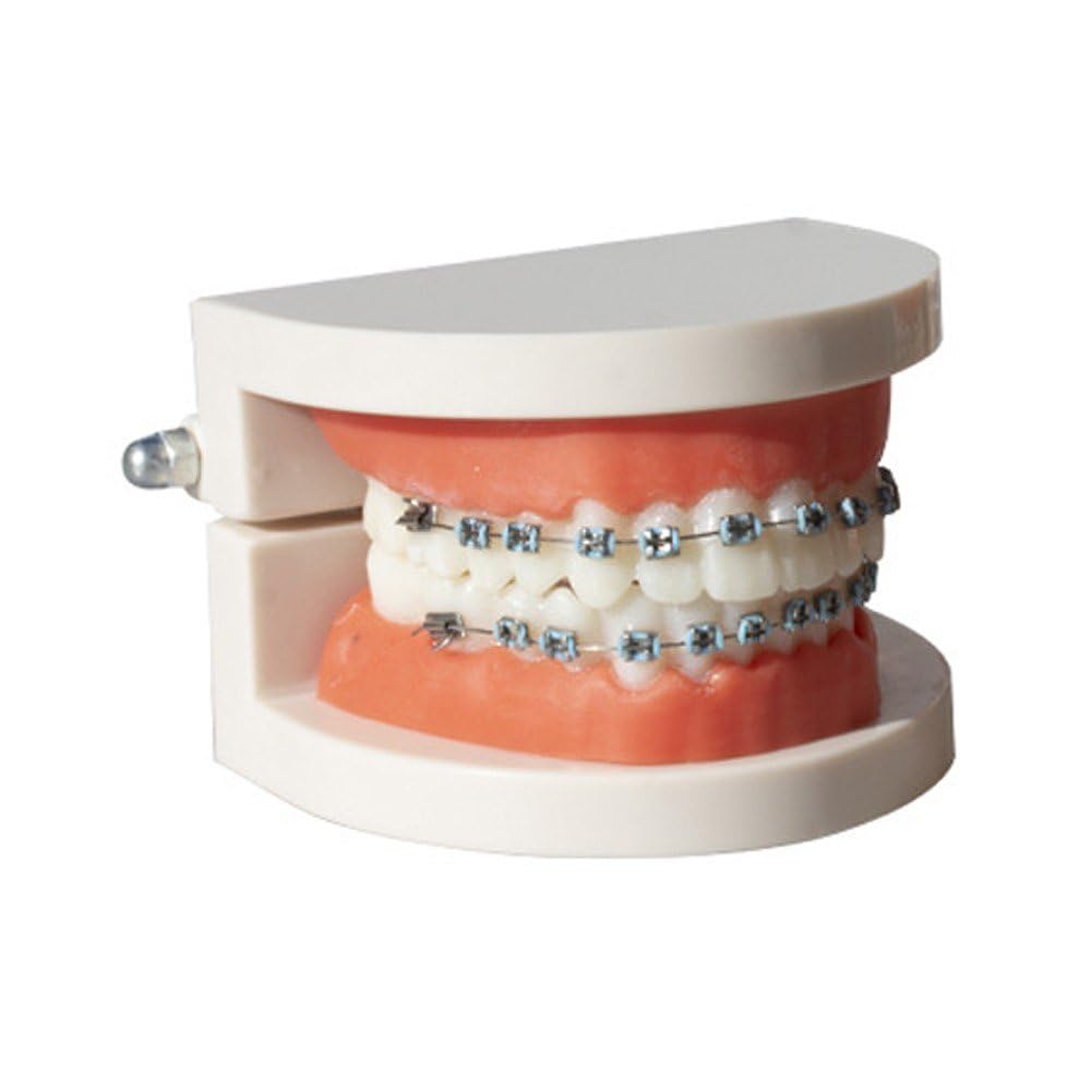 Soporte Dental Metal Azul, Gancho Decoración Temporal Dientes con Alambres Ligaduras Ortodoncia