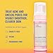 Good Molecules Acne Foaming Cleanser - 2% Salicylic Acid Foam Cleanser - Gentle Acne Face Wash with Alcohol Free Witch Hazel and Aloe - Skin Care for Face