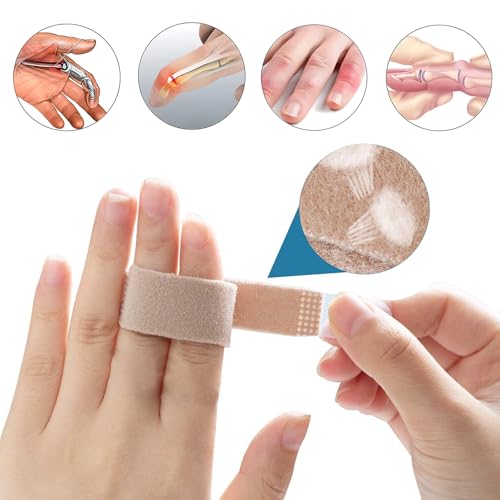 10 Stück Trigger Finger Schiene,Finger Klammer Schiene Fingerbandage für Kleiner Finger, mittelfinger, ringfinger, Bandage Finger, Verstellbare Fingerschutz
