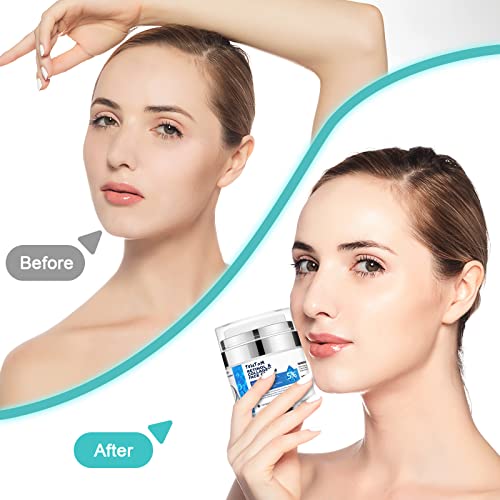 Anti-Wrinkle Retinol Face Creams,Daily Moisturizer With Hyaluronic Acid & Collagen,Advanced Anti-Aging Formula For Lifting Skin - Fine Lines And Dryness (Face Moisturizer 1.7) #TOP5