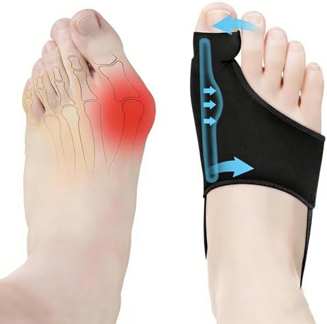 2PCS Bunion Corrector for Women & Men Big Toe,Big Toe Separators,Big Toe Spacers for Women & Men,Orthopedic Bunion Splint-Straightener-Bunion Pads for Bunion Relief-Hallux Valgus Pain Relief,Comfortable & Breathable for Day/Night