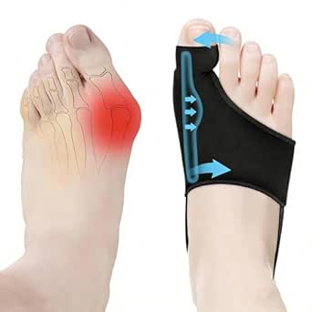 2PCS Bunion Corrector for Women & Men Big Toe,Big Toe Separators,Big Toe Spacers for Women & Men,Orthopedic Bunion Splint-Straightener-Bunion Pads for Bunion Relief-Hallux Valgus Pain Relief,Comfortable & Breathable for Day/Night