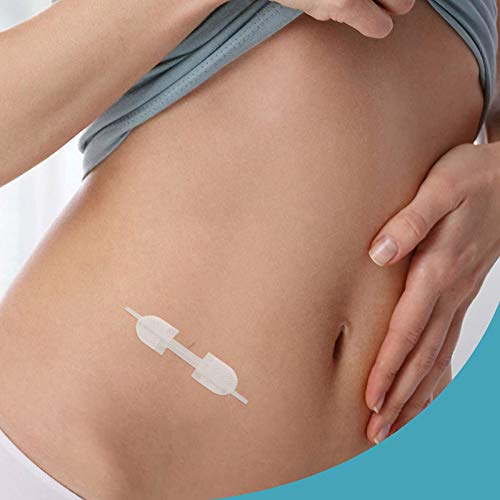EXCEART 3 Peças de Fechamento de Feridas Curativos Adesivos de Ponto Zip Não Tecido Adesivos de Feri