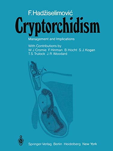 Cryptorchidism: Management and Implications view 2