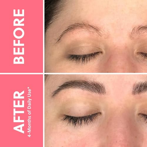 ForChics ForBrow Eyebrow Growth Serum For Thicker Brows - Natural & Organic Conditioner For Fuller and Thick Eyebrows | Vegan & Cruelty-Free Formula | New Innovative Peptides - [0.10 fl. oz/ 3ml] - Thumbnail 3