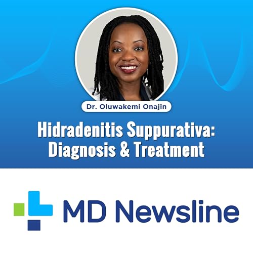 Understanding Hidradenitis Suppurativa: Diagnosis, Treatment, and Emerging Therapies