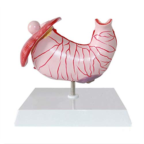 Modelo Anatômico de Estômago Humano Mudanças Patológicas Anatomia para Sala de Aula Estudo Modelo Mé