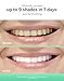 Supersmile Extra White Teeth Whitening System , 2 Count (Pack of 1)
