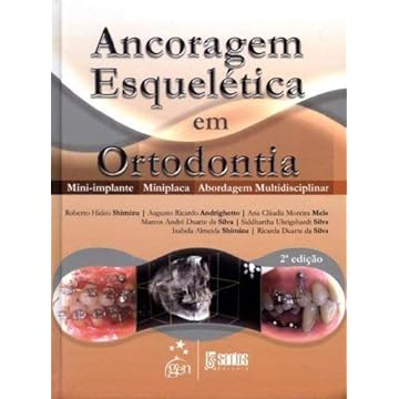 Capa do livro Ancoragem Esquelética em Ortodontia - Mini-implante - Miniplaca - Abordagem Multidisciplinar