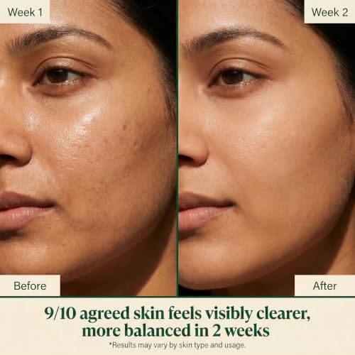 Image of Kalyntika Supergreen Reset Mask | Purify Oily & Congested Skin | 50g | Kale, Spirulina, Moringa, Bentonite Clay. Skin feels clear & lighter in 2 weeks