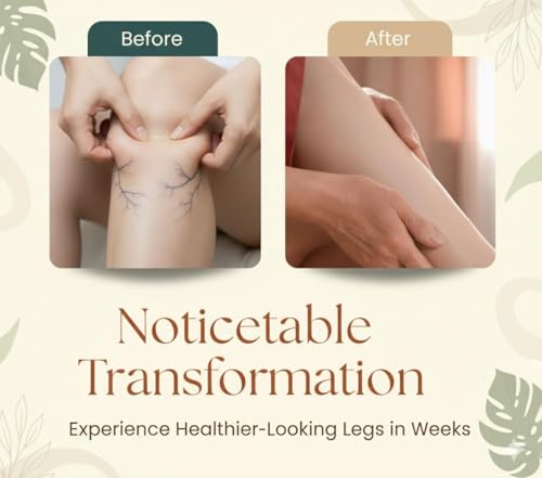 Image of Varicose Veins Spray - Natural Herbal Formula for Fast Relief | Reduces Swelling, Relieves Pain & Promotes Blood Circulation | Easy-to-Use Spray for Legs, Ankles & Feet (PACK OF 2, 60 ML)