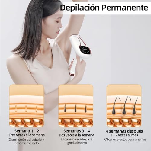 La Mejor Selección de Maquina foto depilación - cinco favoritos. 15 Imagen adicional