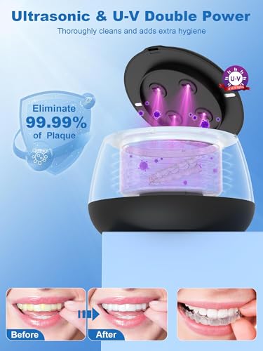 Image of KUNPHY Ultrasonic Retainer Cleaner Machine, 48kHz Dental Cleaning Pod Home | 4 LED Light 48KHz Ultrasound Portable Mouthguard Night Guard Cleaner, IPX7 Waterproof, Quiet 45dB, Overheat Protection, Black