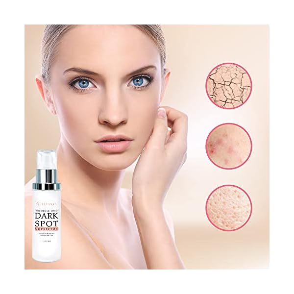 Dark-Spot-Remover-Corrector-for-Face-Body-Dark-Spot-Melasma-Hyperpigmentation-Sunspots-Treatment-Advanced-Ingredients-Kojic-Acid-Salicylic-Acid-Azelaic-Acid-and-Vitamin-C Dark Spot Remover Corrector for Face & Body - Dark Spot, Melasma, Hyperpigmentation & Sunspots Treatment - Advanced…