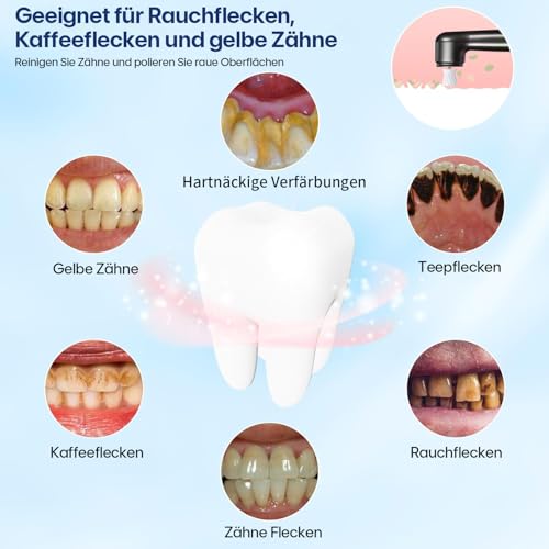 Zahnsteinentferner Elektrisch zahnpolierer Menschen Zahnreinigungsset Professionell, Zahnreinigung Set Ultraschall Zahnbürste mit 5 Modi und 3 Polierpasten für Zahnaufhellung & Zahnreinigung