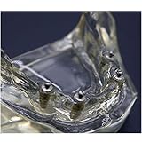 Zoom IMG-1 wotzov modello di denti tipodonte Zoom IMG-1 wotzov modello di denti tipodonte