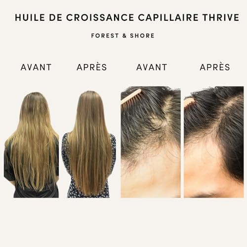 Soins des Cheveux et Huile pour la Pousse des Cheveux à l'Huile de Ricin et d'Huile de Coco, Masque Capillaire pour une Pousse des Cheveux Très Rapide avec de l'Huile de Romarin – Image 3
