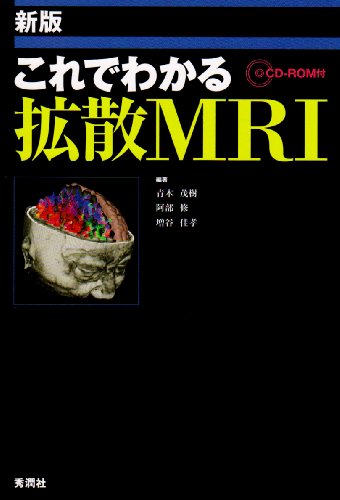 スマホ 無料電子書籍 新版 これでわかる拡散MRI バイ