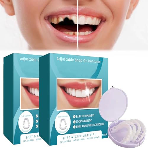 Verstellbare Snap-On-Prothesen, Künstliche Zähne, Verstellbare Veneers-Prothesen Für Männer Und Frauen, Schützen Sie Ihre Zähne Und Gewinnen Sie Ein Selbstbewusstes Lächeln Zurück (2 Stk)